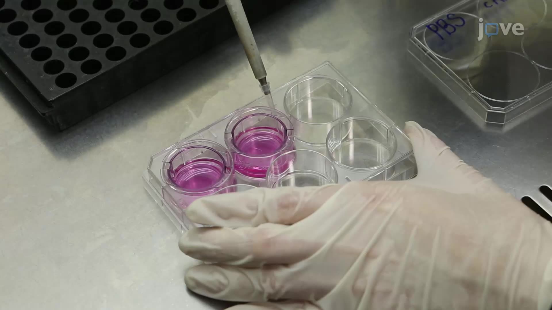 Using a Macrophage Conditioned Medium to Promote Neuron Extensions