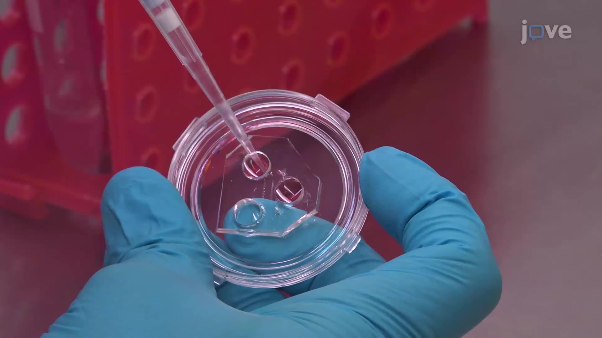 Video: Seguimiento del transporte axonal de orgánulos en neuronas ...