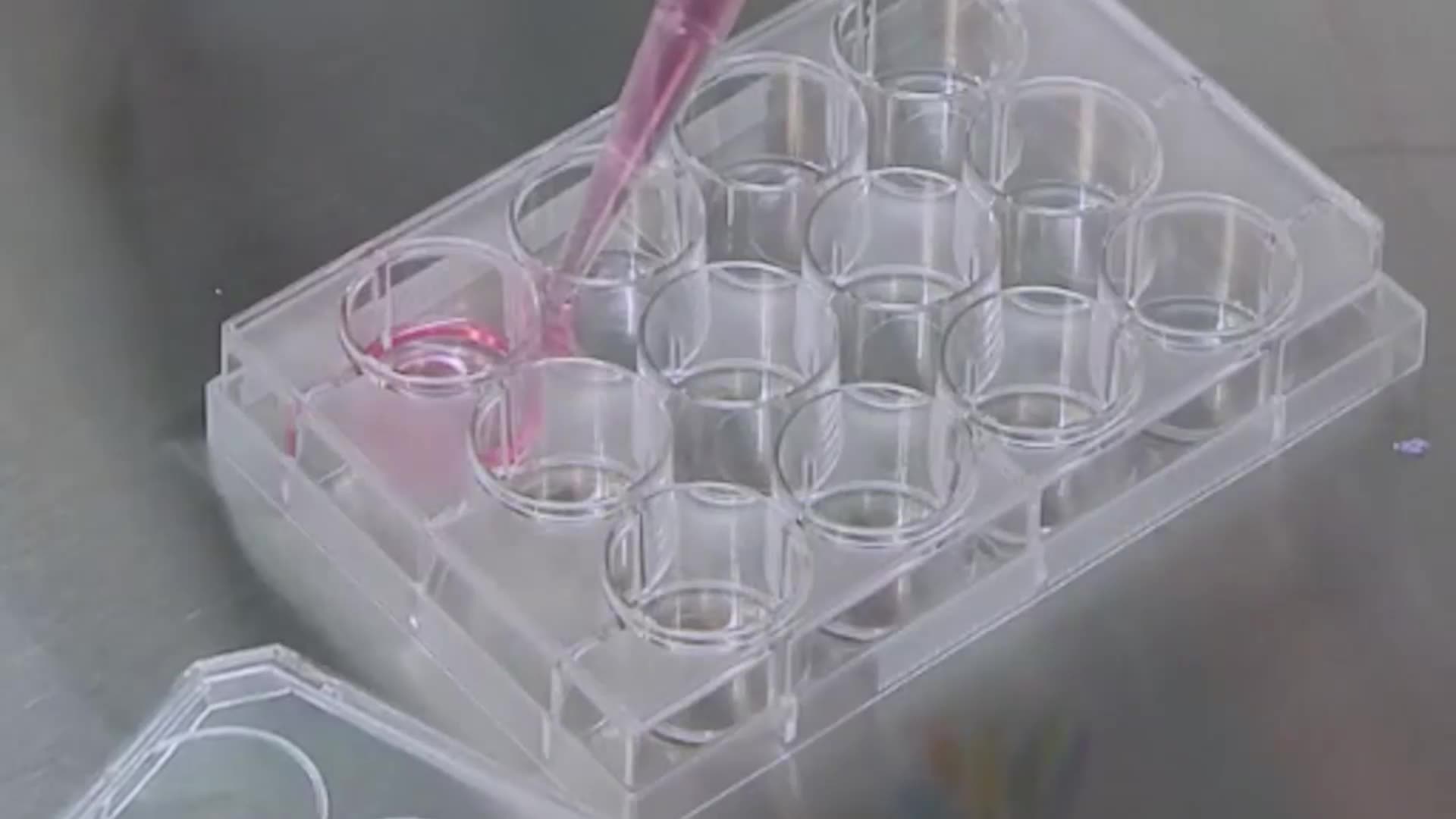 בידוד ותרבית של נוירונים גרגיריים צרבלריים ראשוניים של עכבר