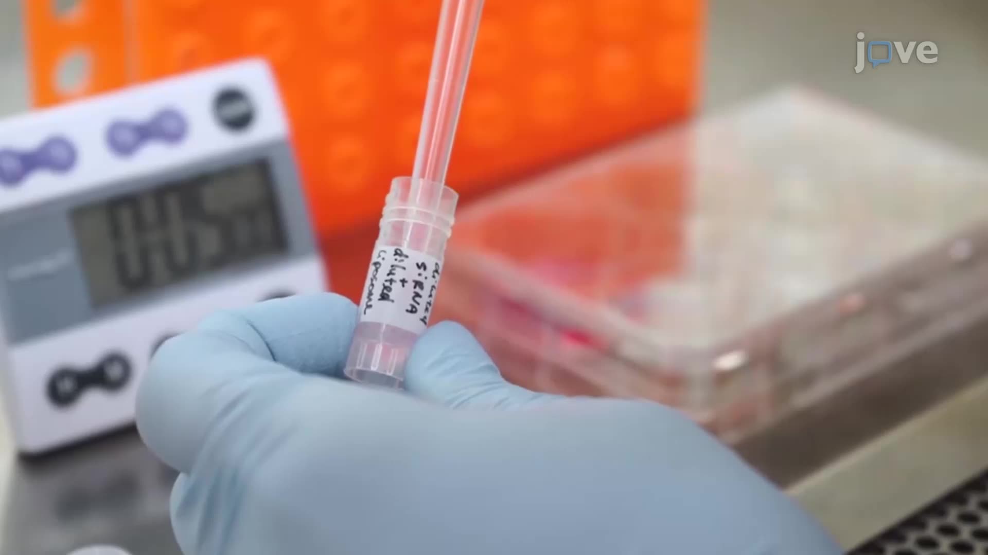siRNA-Mediated Gene Silencing in Neural Stem Cells