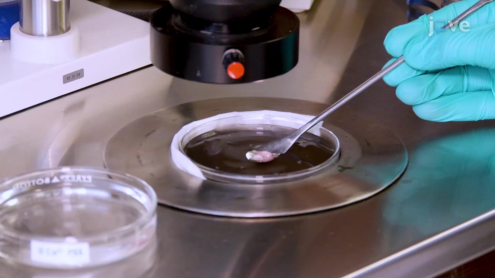 Preparing Cerebral Endothelial Tubes from Mouse Parenchymal Arterioles