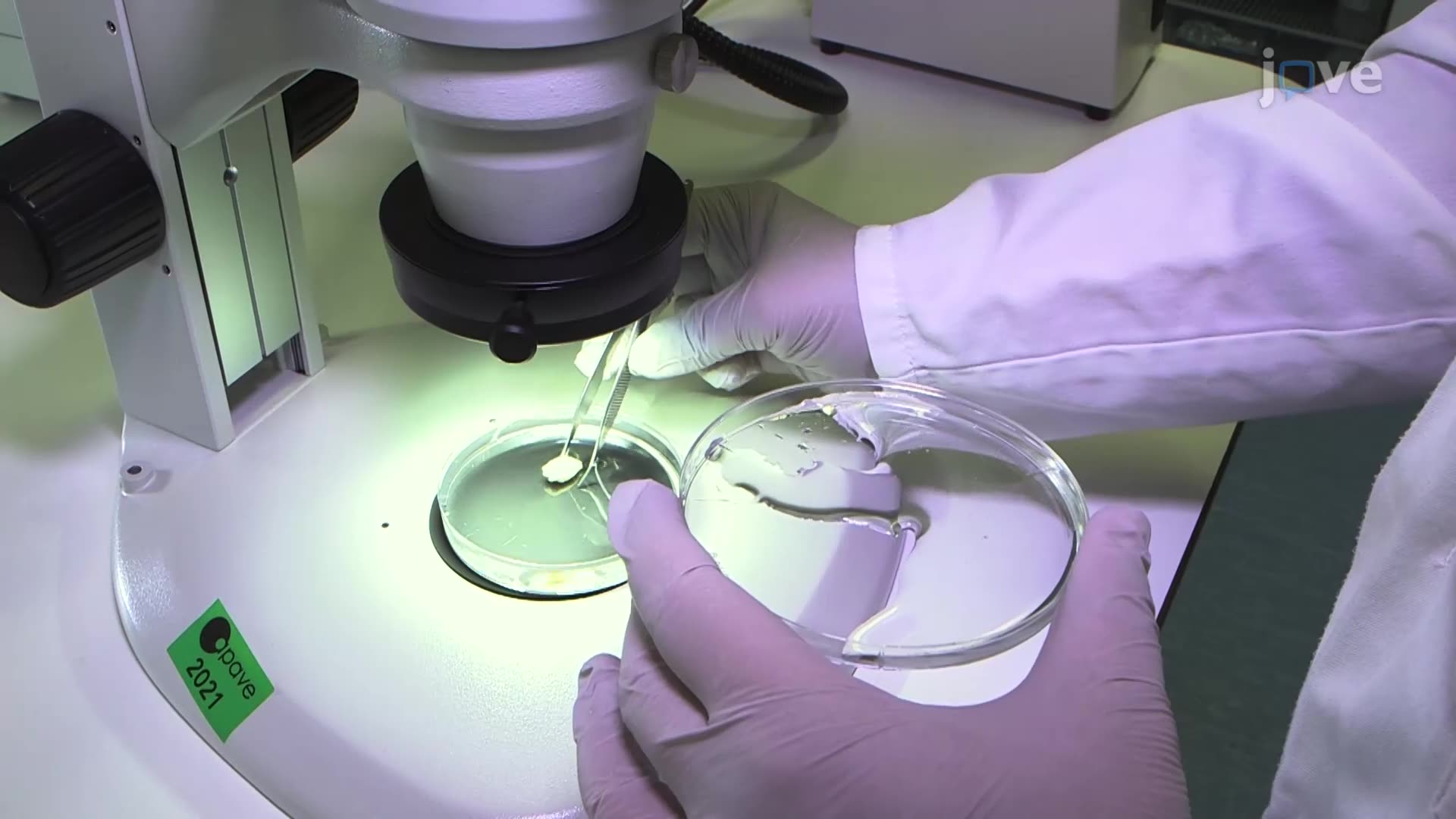 Isolating Immune Cells from Mouse Choroid Plexuses