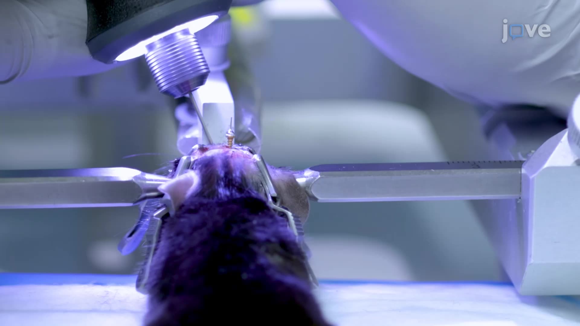 Implantation of Electrodes into a Mouse Cortex for Electrocorticographic Recordings