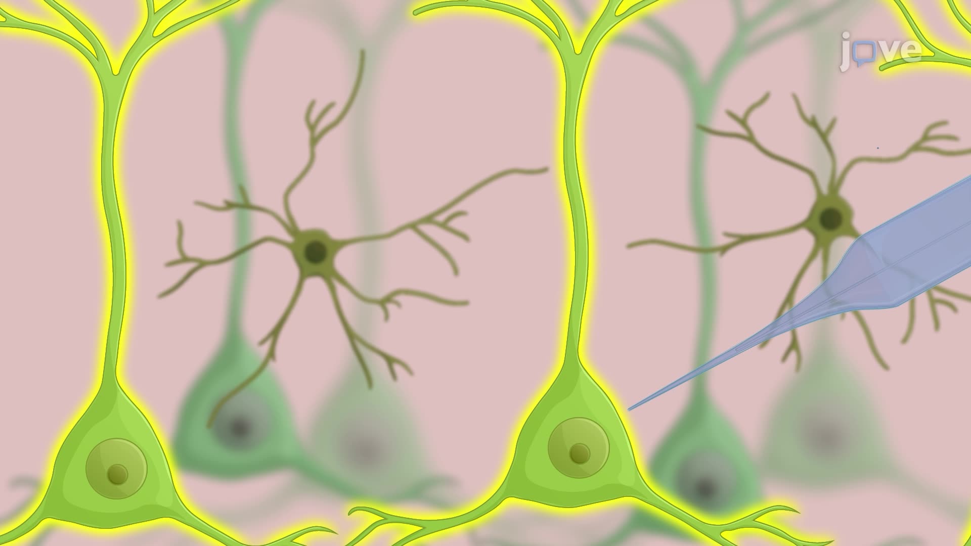Automated Image-Guided Patch Clamp Technique for Studying Neurons in Brain Slices