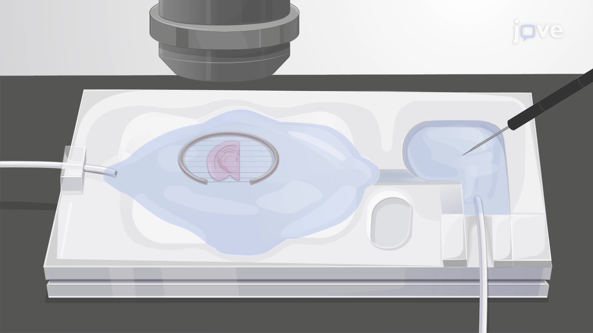 Generating Local Cornu Ammonis 1 (CA1) Gamma Oscillations Using Tetanic Stimulations in a Hippocampal Brain Slice