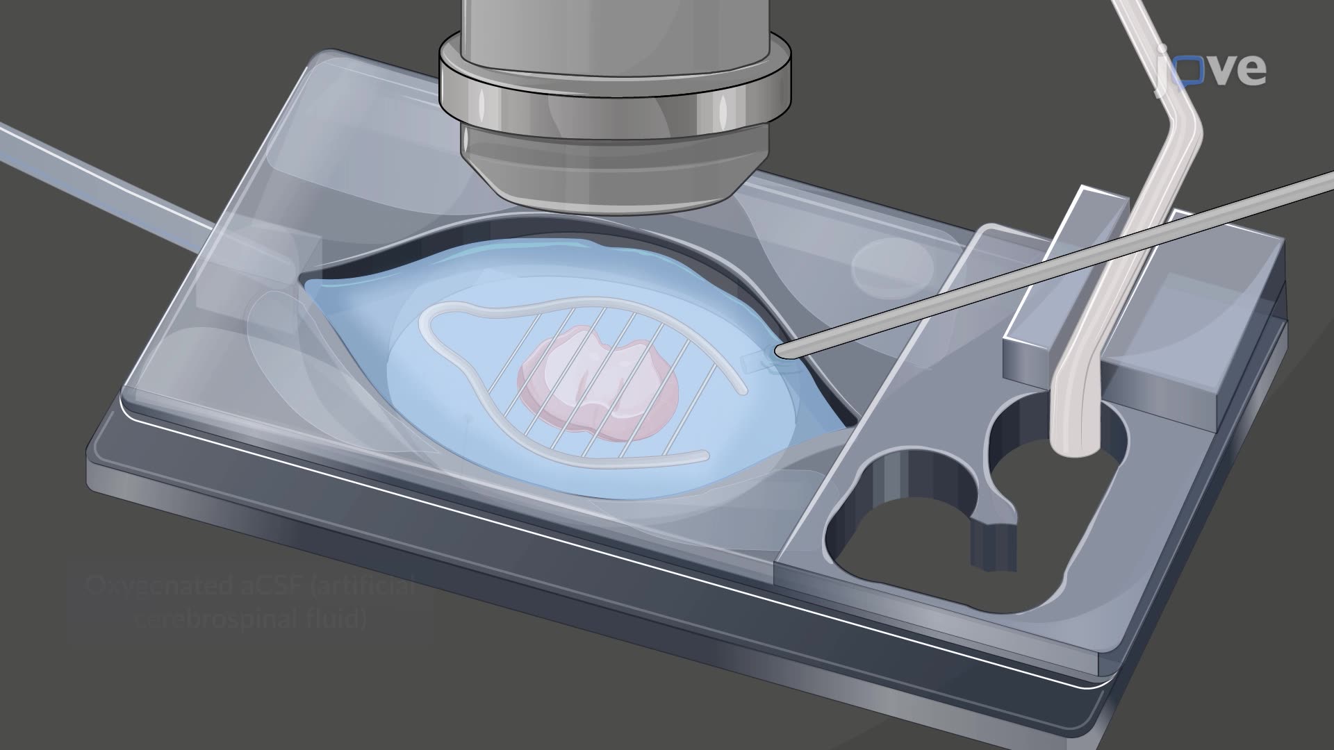 Auditory Nerve Root Stimulation and Postsynaptic Current Recordings in a Mouse Brain Wedge Slice