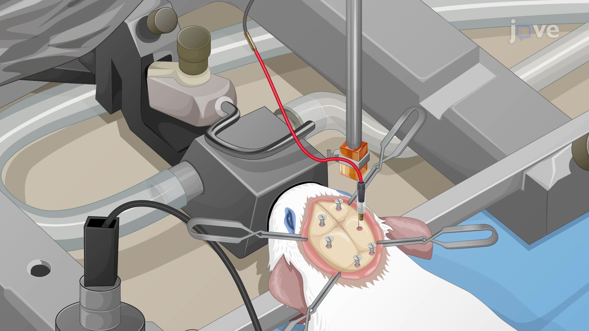 Implanting an Electrode into the Subthalamic Nucleus of a Rat