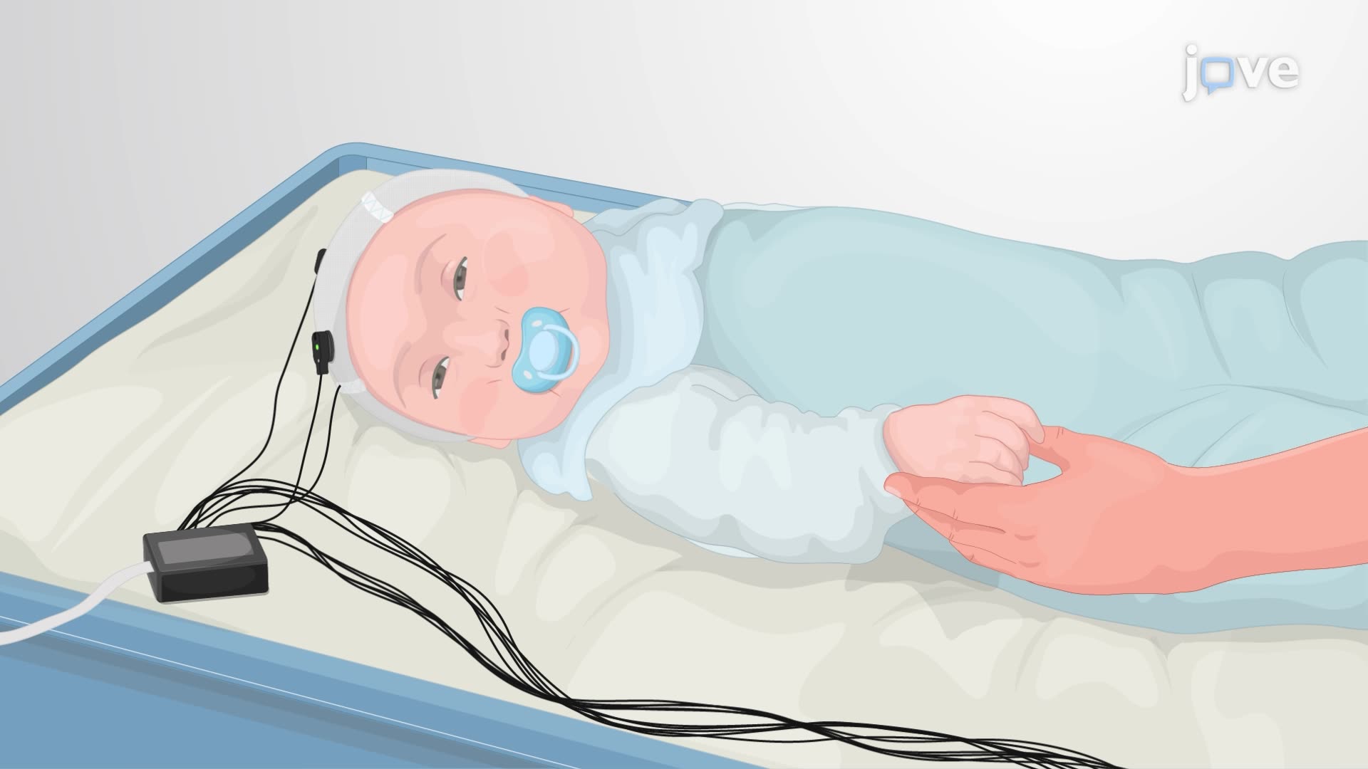 EEG'ye Bağlı Düz Uçlu Bir Prob Kullanarak Yenidoğanlarda Ağrıya Bağlı Beyin Aktivitesinin Ölçülmesi