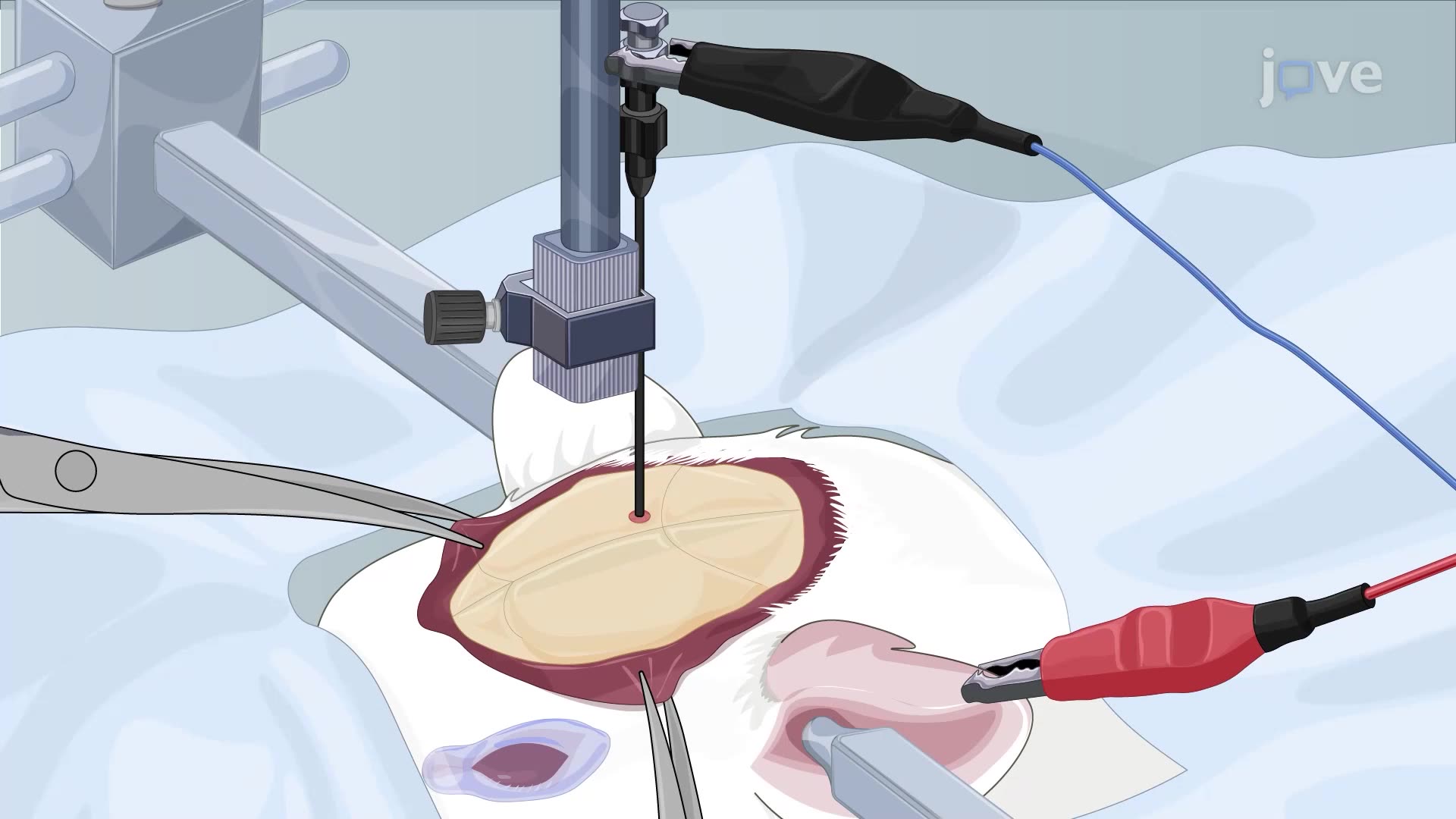 Inducing Acute Pons Infarction in a Rat Model Using Electrical Stimulation