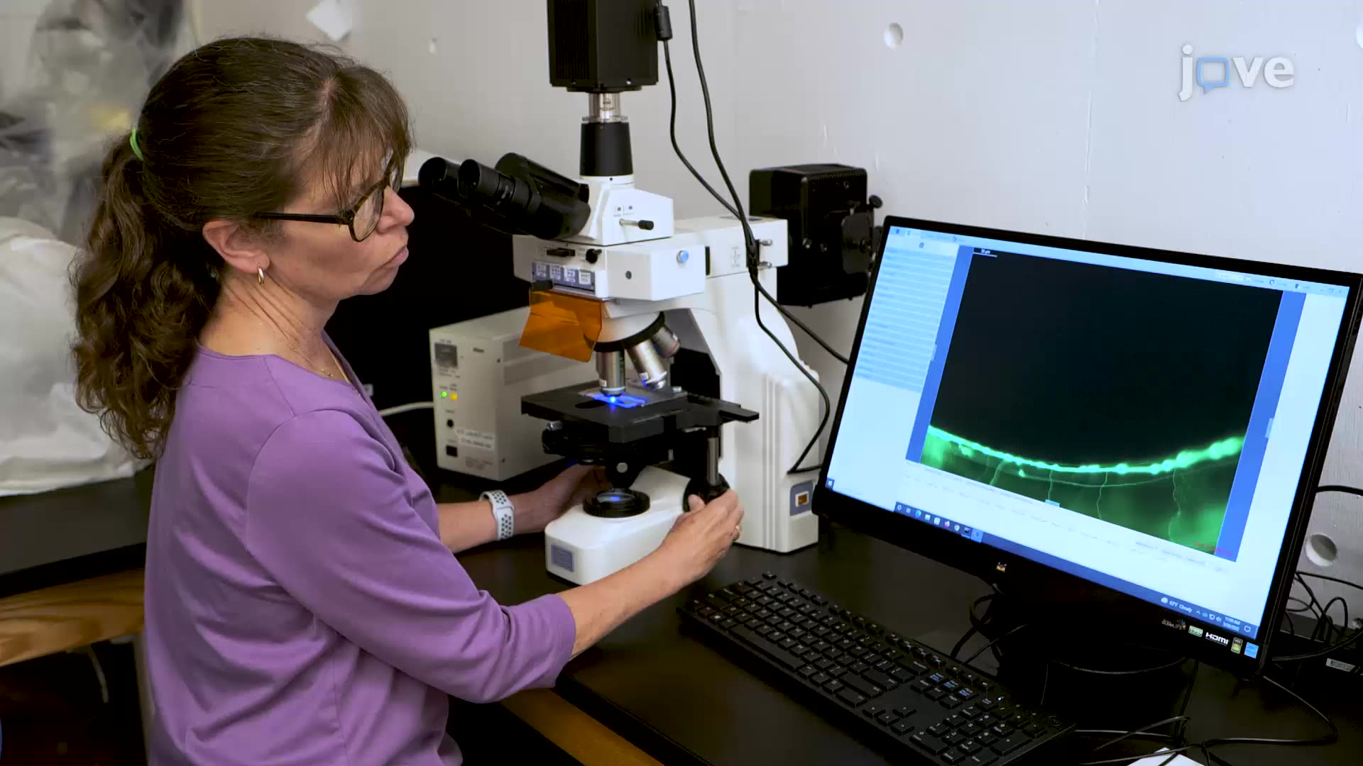 Studying the Effect of Pesticides on Caenorhabditis elegans Neurons