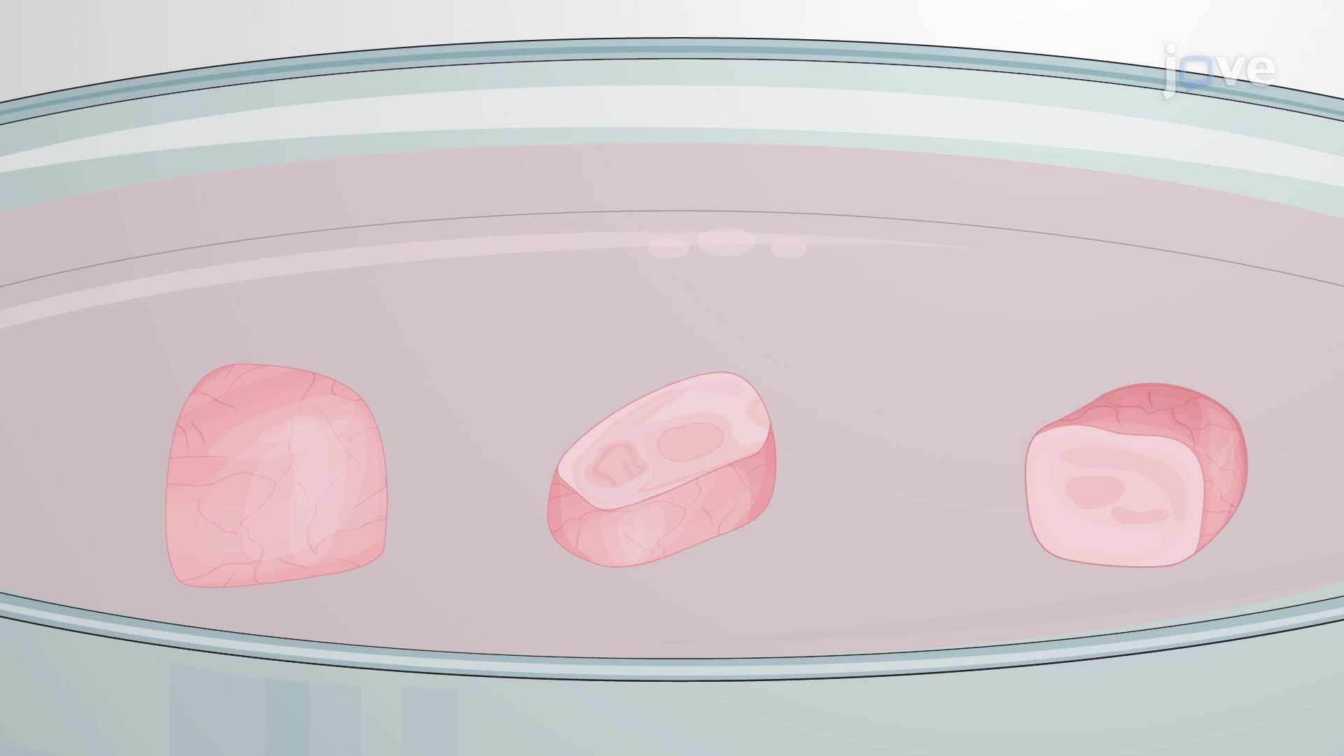 Obtaining Cell Suspensions from Ischemic Mouse Brain Tissues