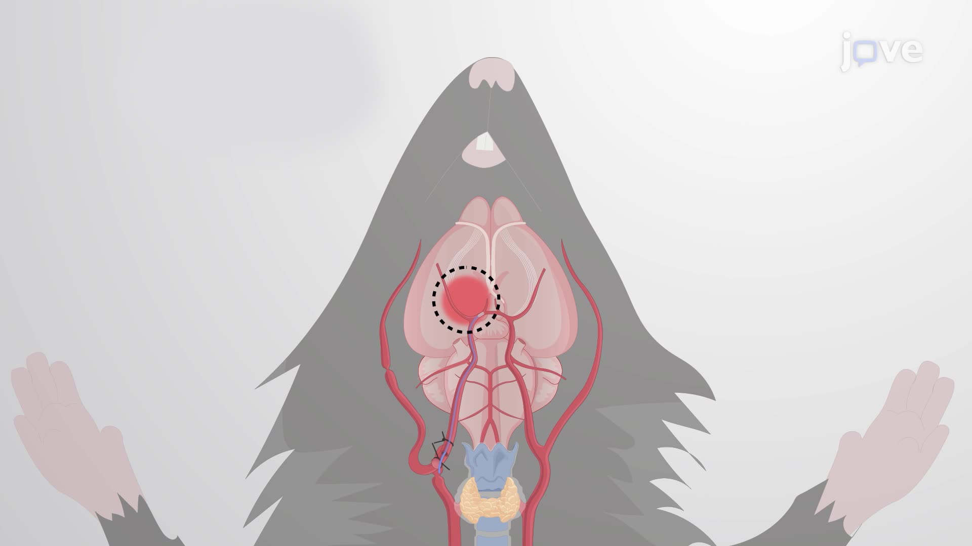 Induction of a Subarachnoid Hemorrhage in a Mouse Model through Endovascular Perforation