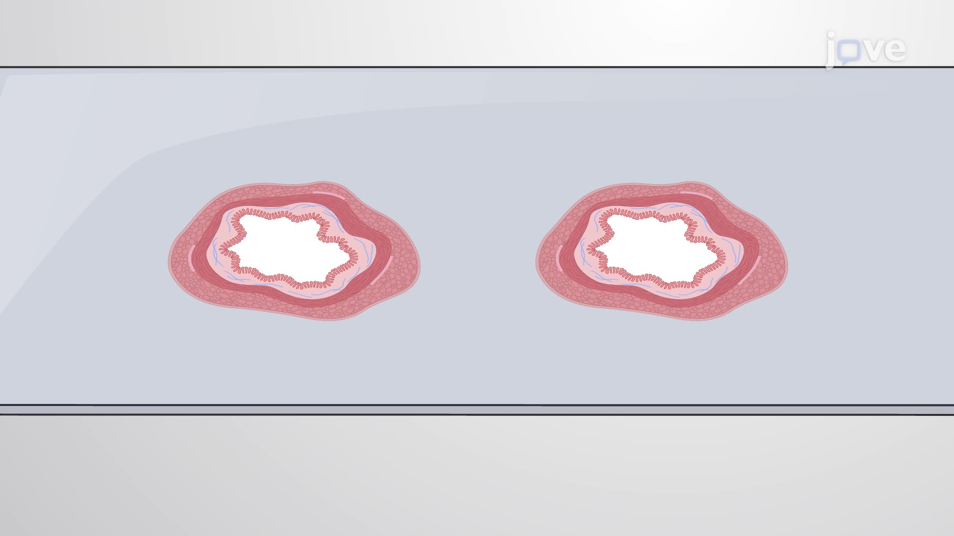 Immunohistochemical Staining of S-100 Protein in Human Rectal Suction Biopsy Sections