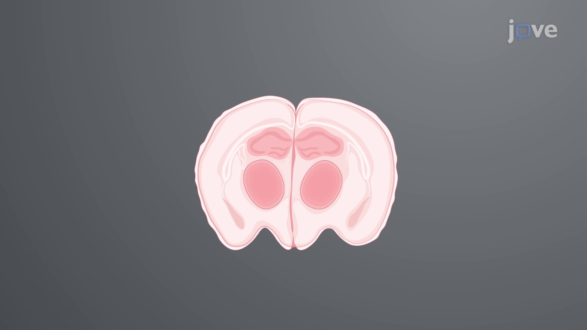 Treatment of Rat Coronal Slices with a Neurotoxic Peptide
