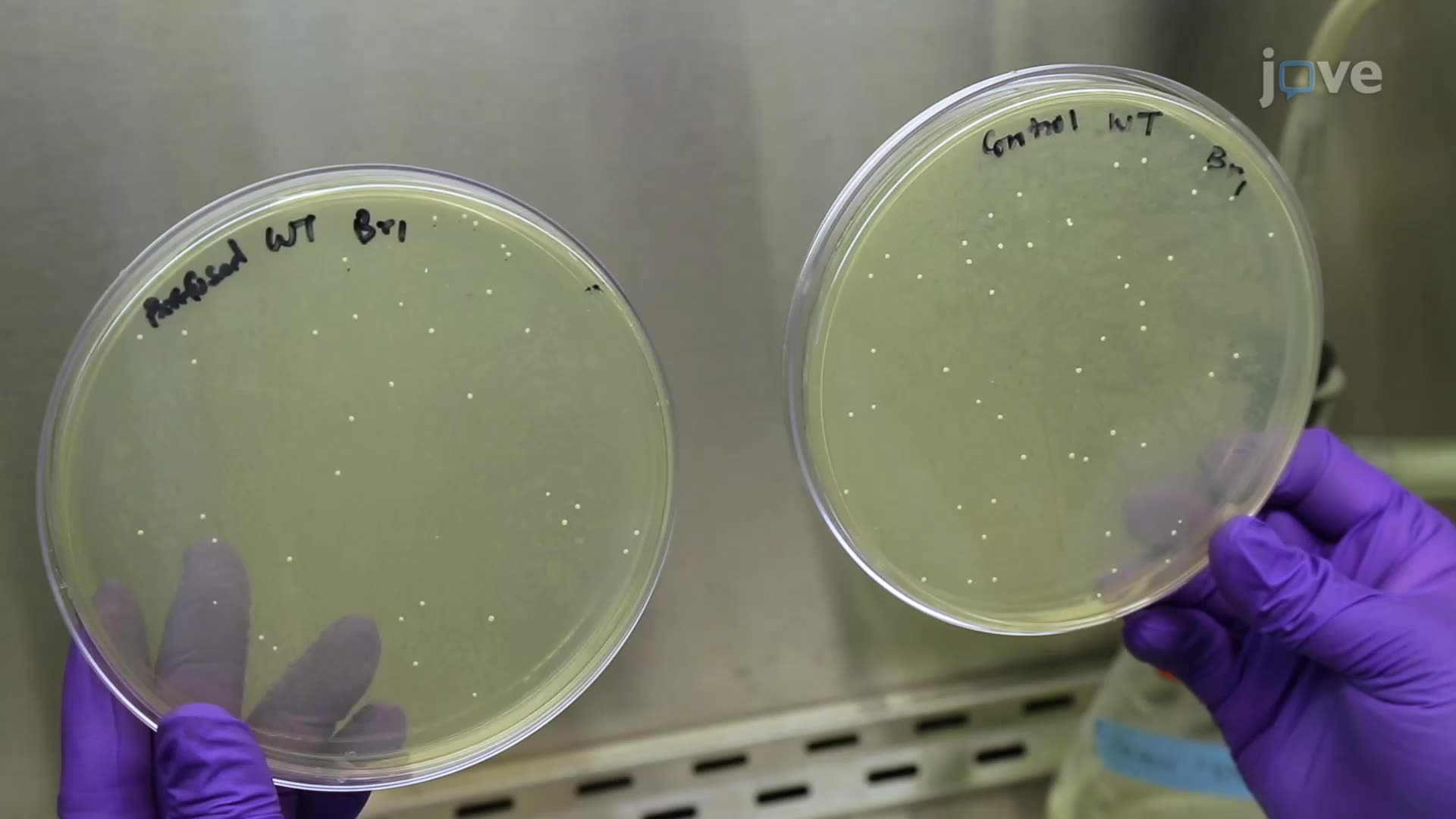 Assessing Bacterial Colonization in a Mouse Brain following Listeria monocytogenes Infection