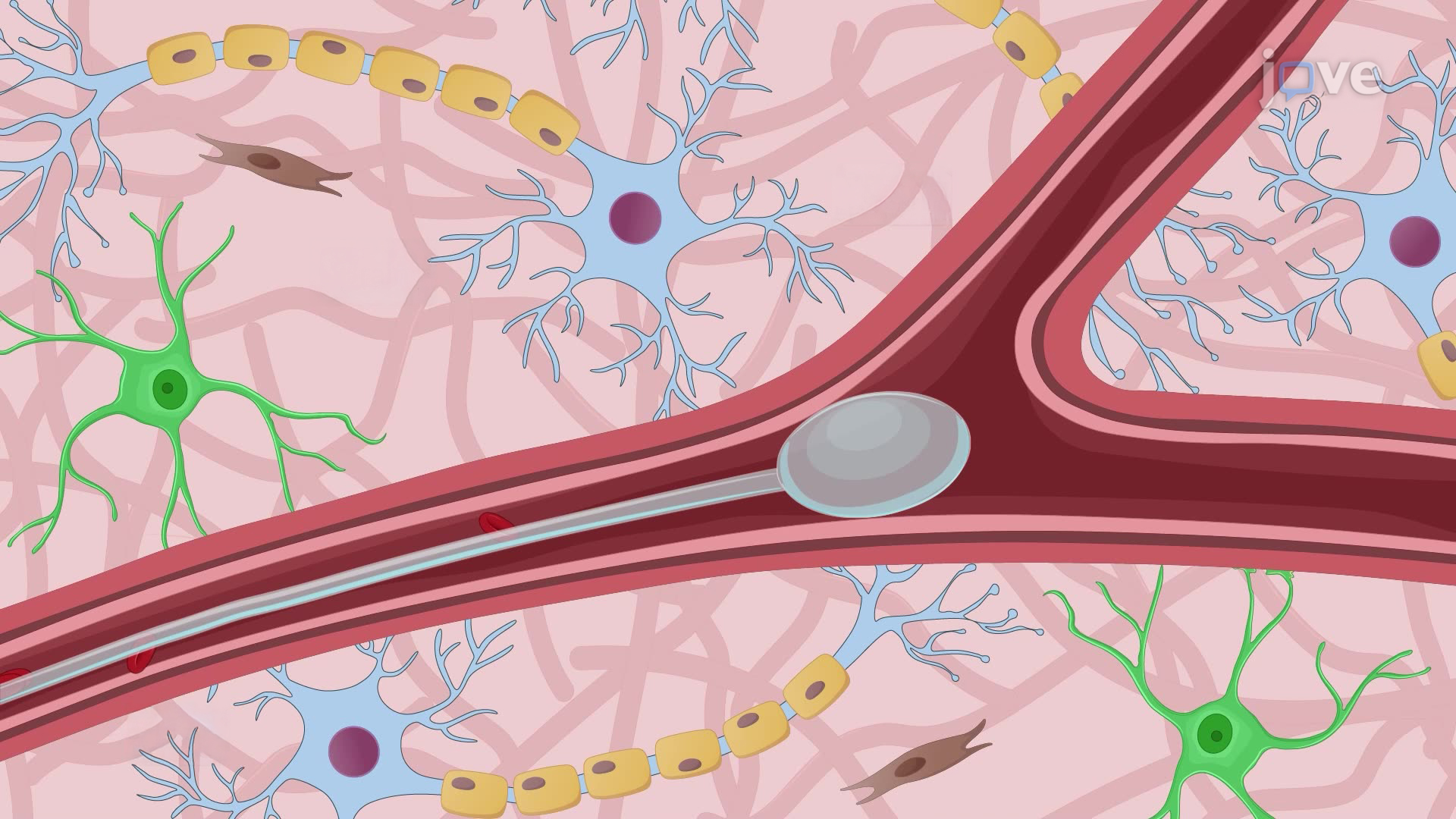 Inducing Ischemic Stroke via Middle Cerebral Artery Occlusion Using a Thread Bolt