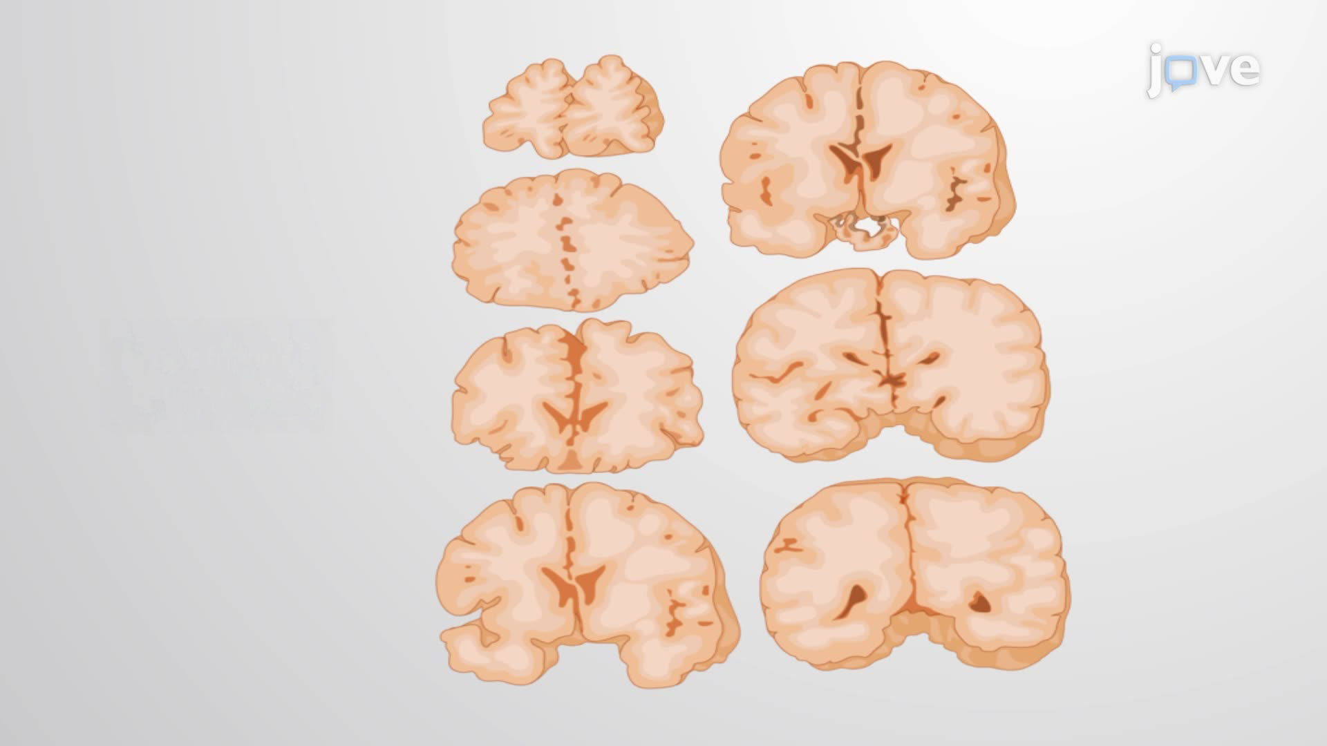 Symmetric Bihemispheric Sectioning of the Human Postmortem Brain
