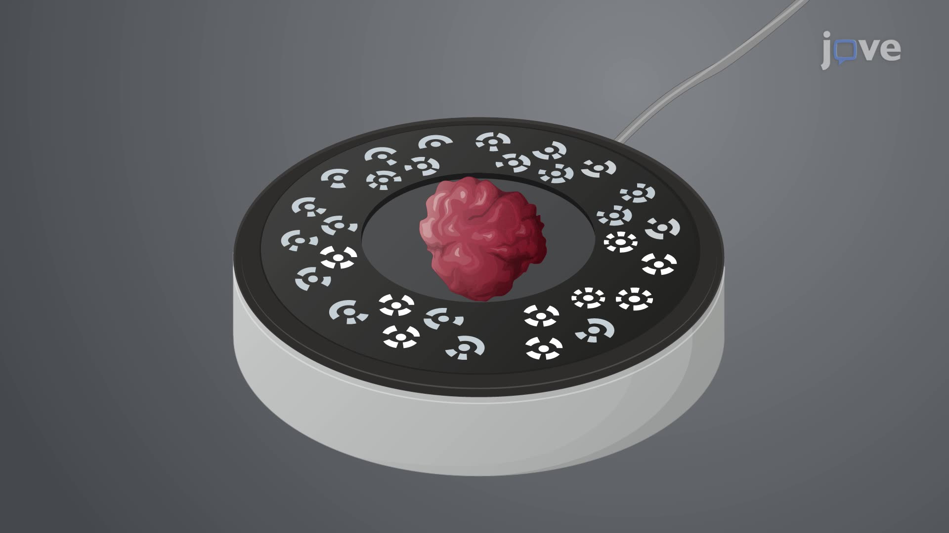 Augmented Reality-Based Visualization of a Resected Tumor Specimen