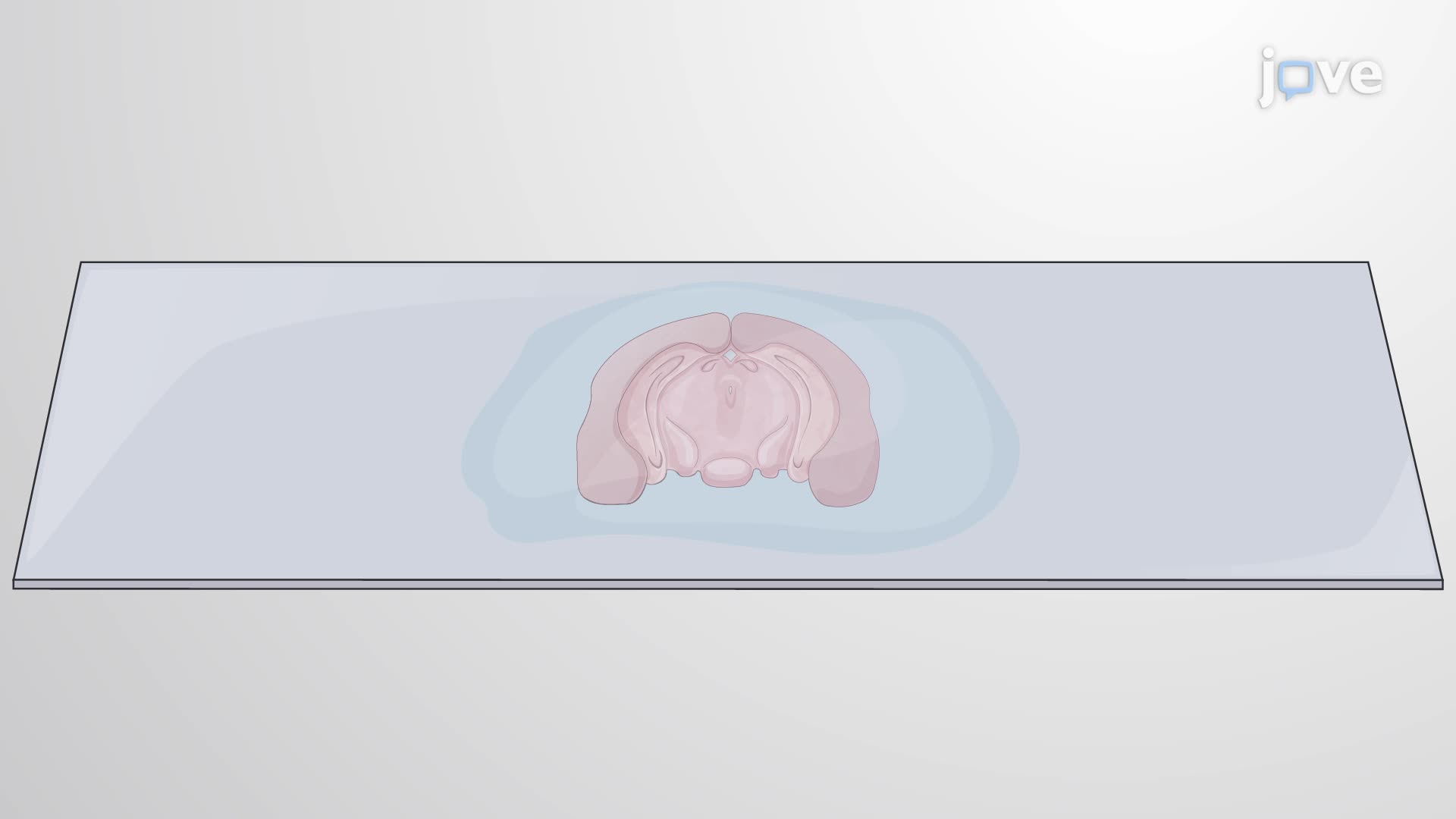 TUNEL Assay for Detecting Apoptotic Cell Death in a Brain Slice