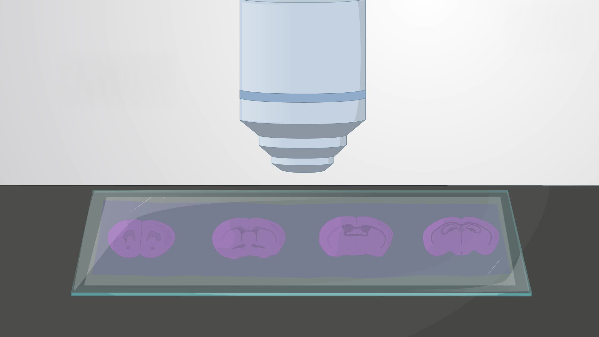Assessing Cerebral Infarctions in a Rat Brain Using Hematoxylin and Eosin Staining