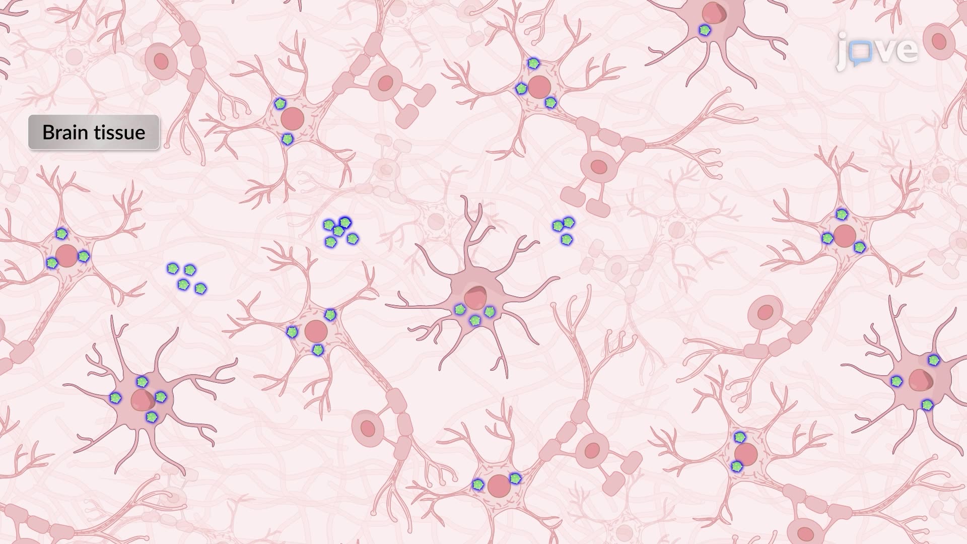 Immunohistochemical Detection of Pathogenic Bacteria in Human Brain Tissue