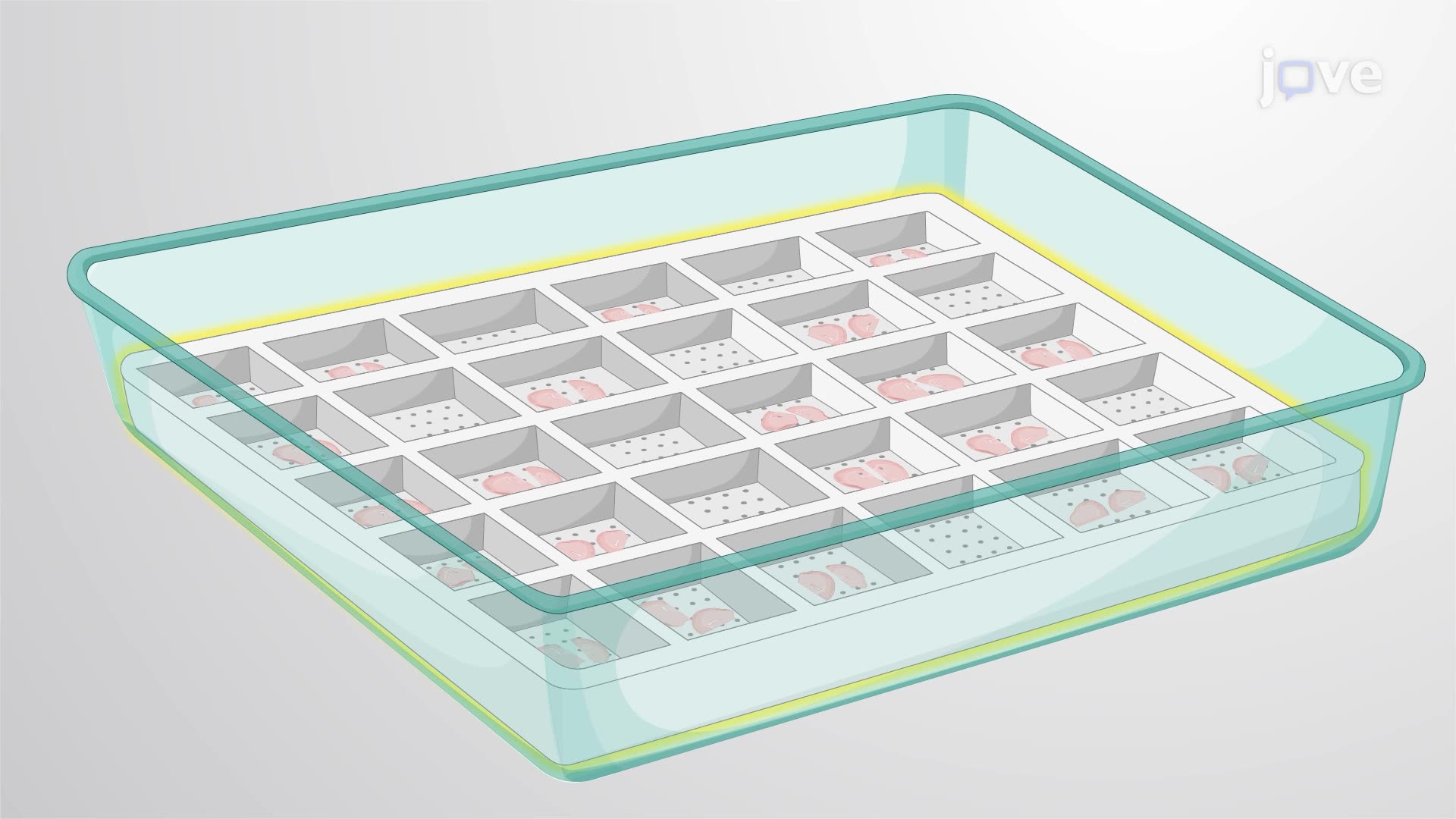 Assessing Neuronal Degeneration in Mouse Brain Sections Using Silver Staining