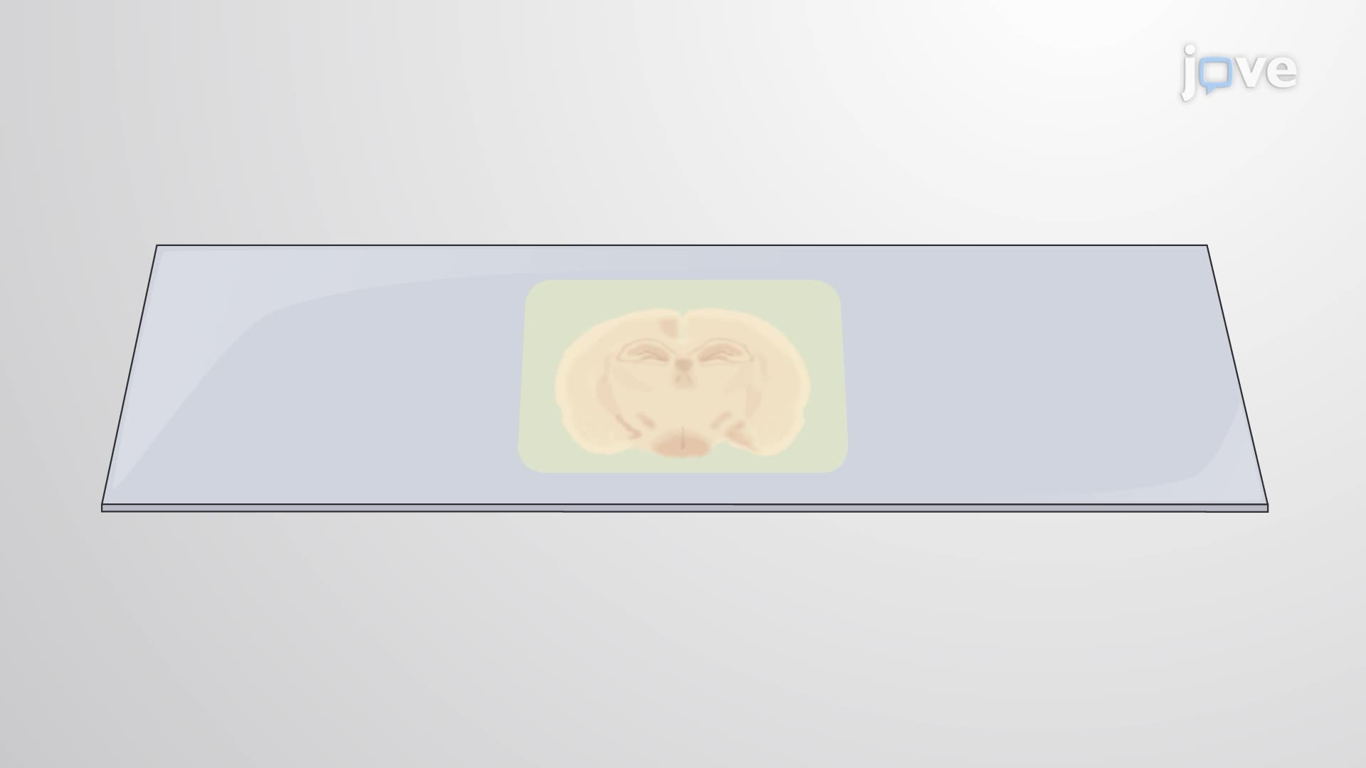 Congo Red Staining to Visualize Amyloid Fibrils in Cerebral Vessel Walls