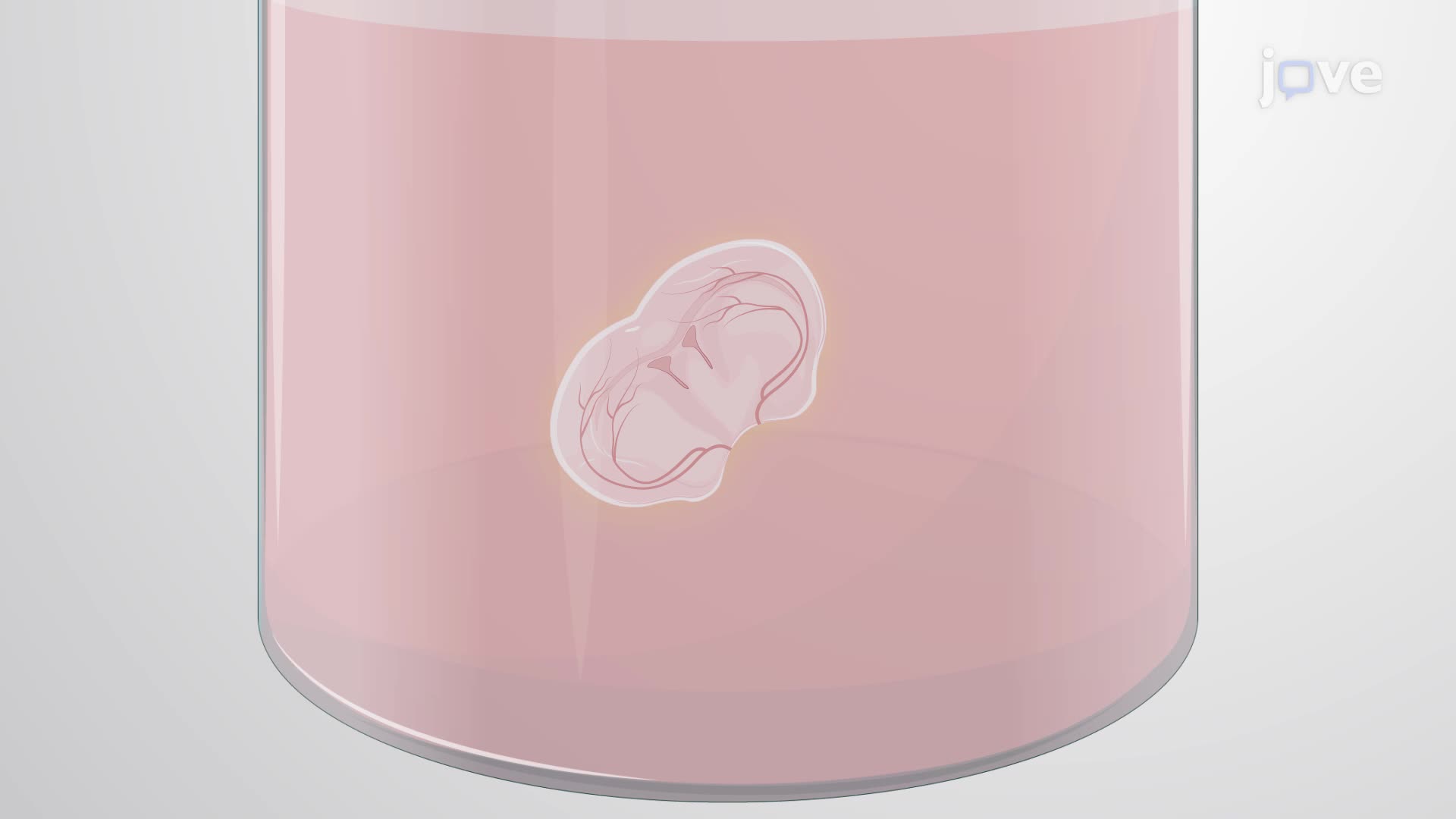 Thioflavin-S Staining of Amyloid-Beta Aggregation in Cerebral Hypoperfused Mouse Brain Tissue