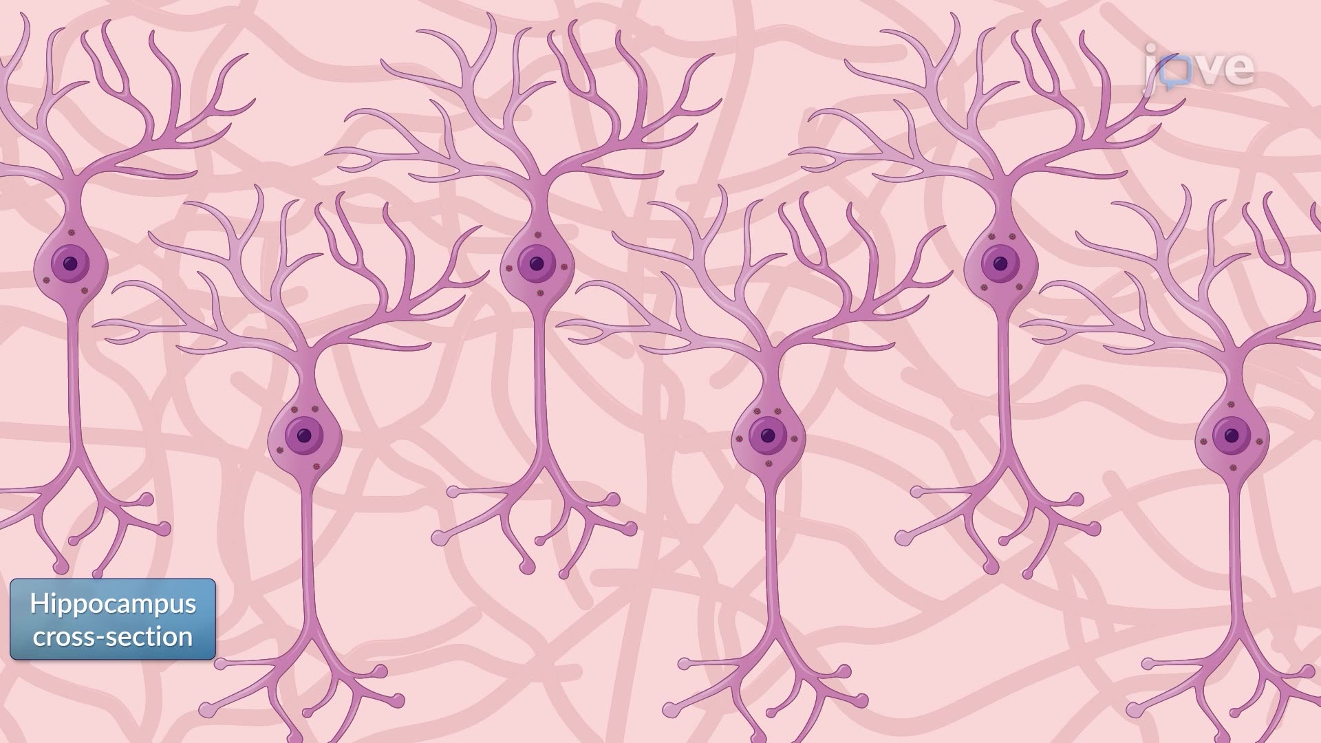Silver Staining of Neurofibrillary Tangles in Brain Sections from a Mouse Model of Alzheimer's Disease