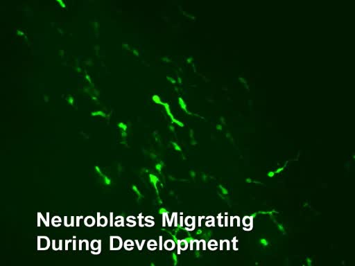 The Transwell Migration Assay
