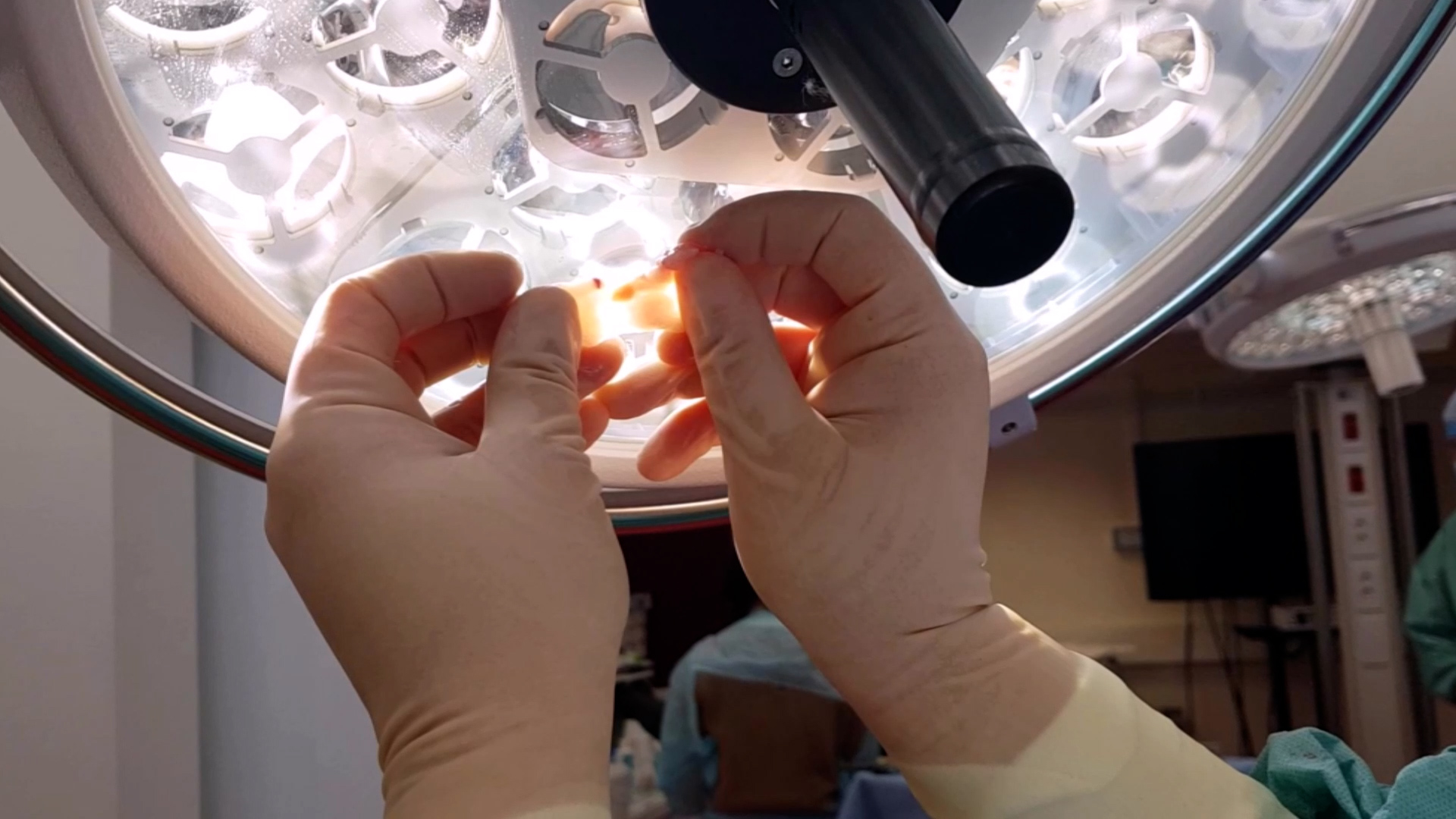 Procurement of Parathyroid Glands from Living Donor Pigs and Ex Vivo Identification