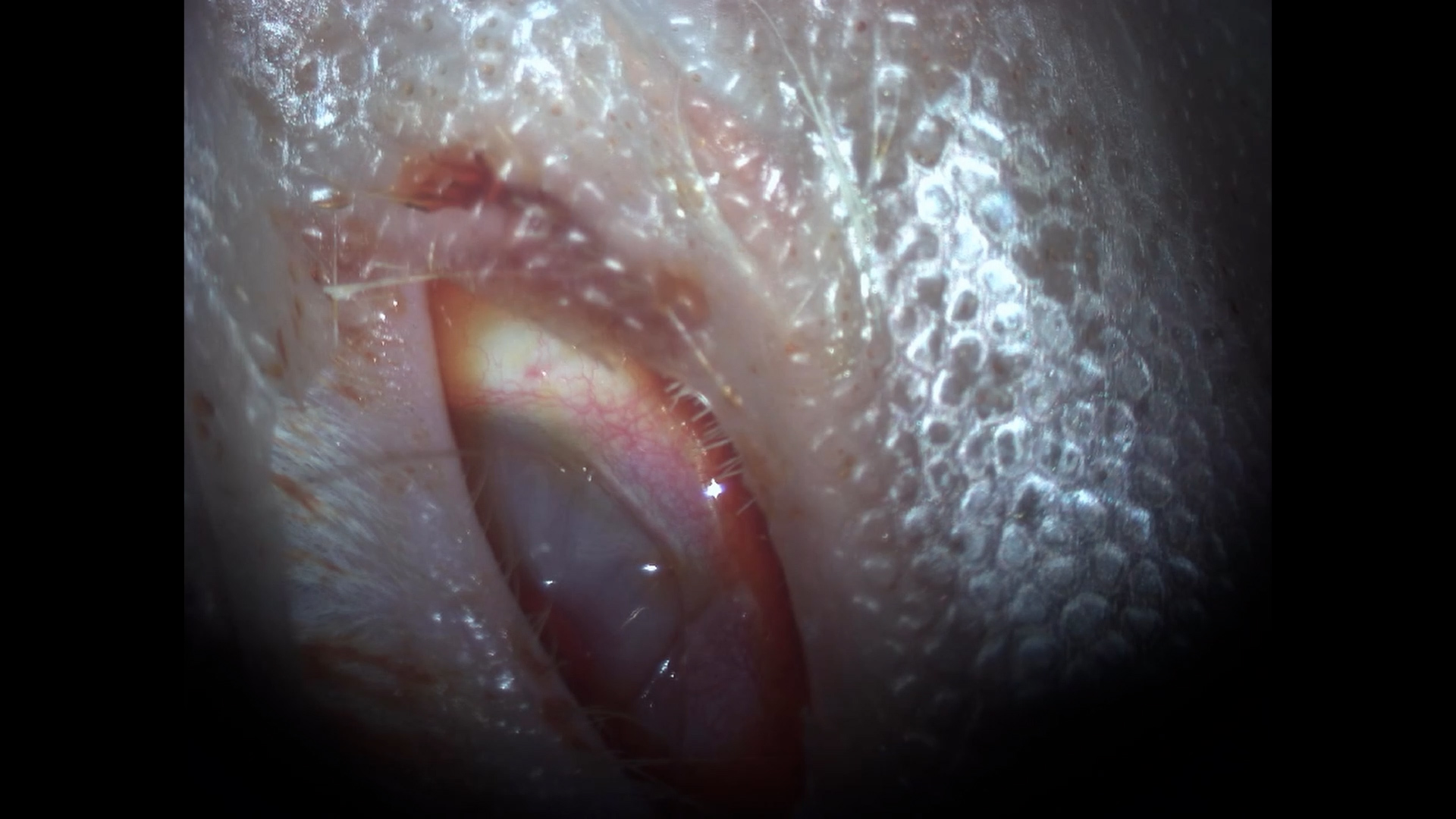 A Surgical Approach for Optic Nerve Crush in a Rabbit Model