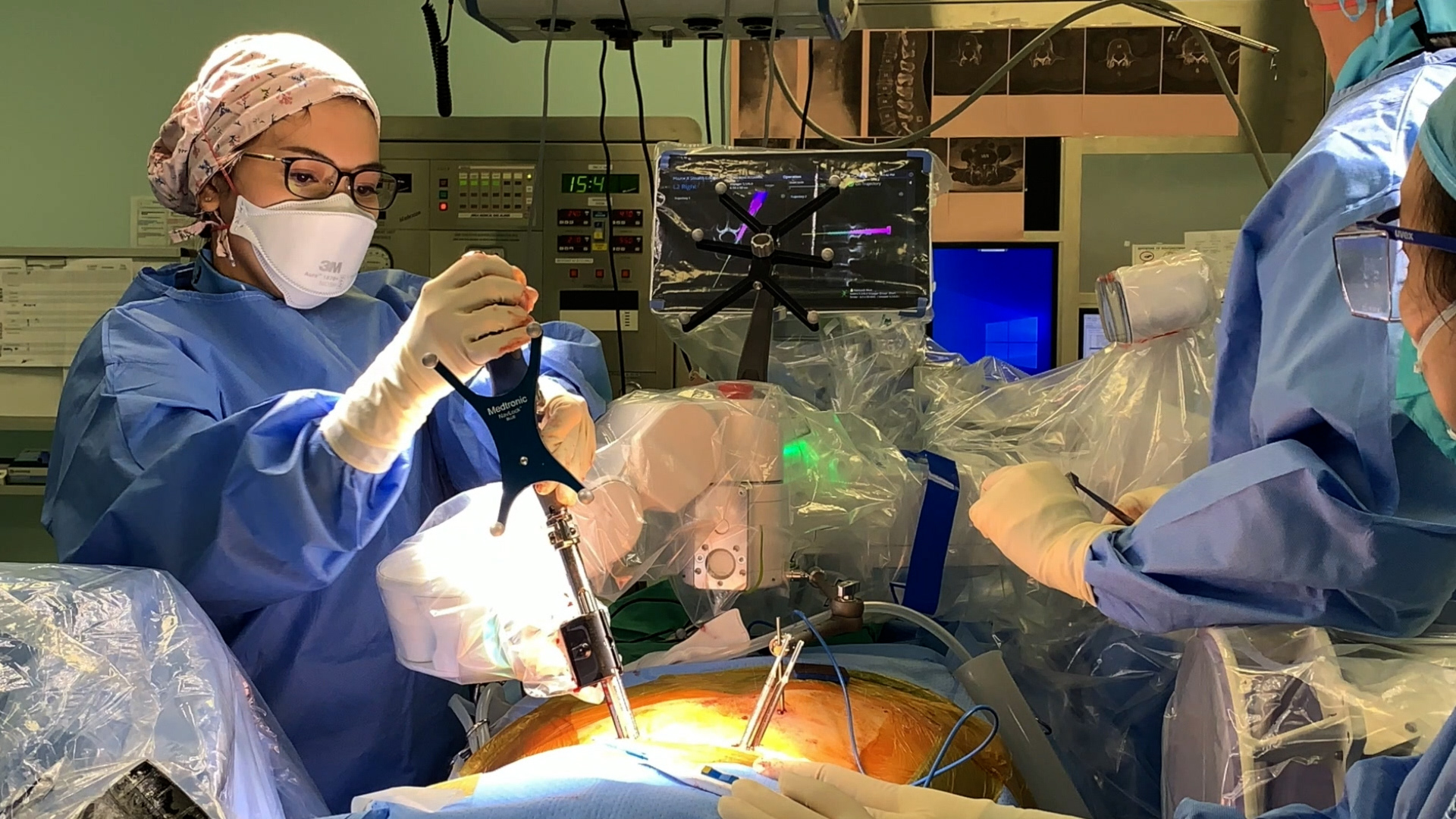 Multilevel Oblique Lumbar Interbody Fusion in Degenerative Lumbar Disc Disease with Instability