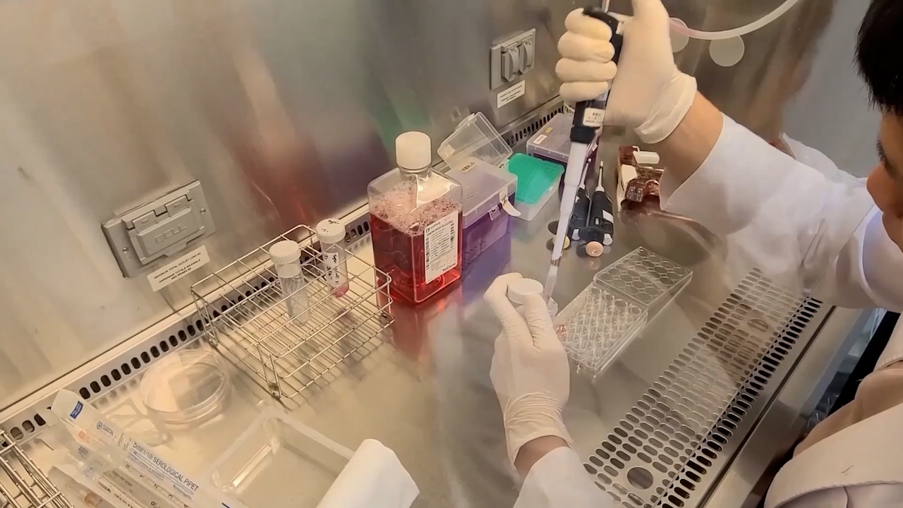 Detection of Anti-MDA5 Autoantibodies Using HeLa Cells and Immunocytochemistry with Light Microscopy