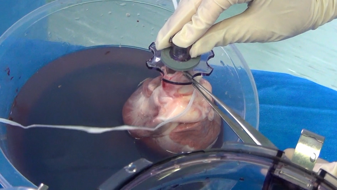 Innovative Strategies for Organ Preservation in Heart Transplantation: Uniform Cooling Preservation and Ex-situ Normothermic Perfusion