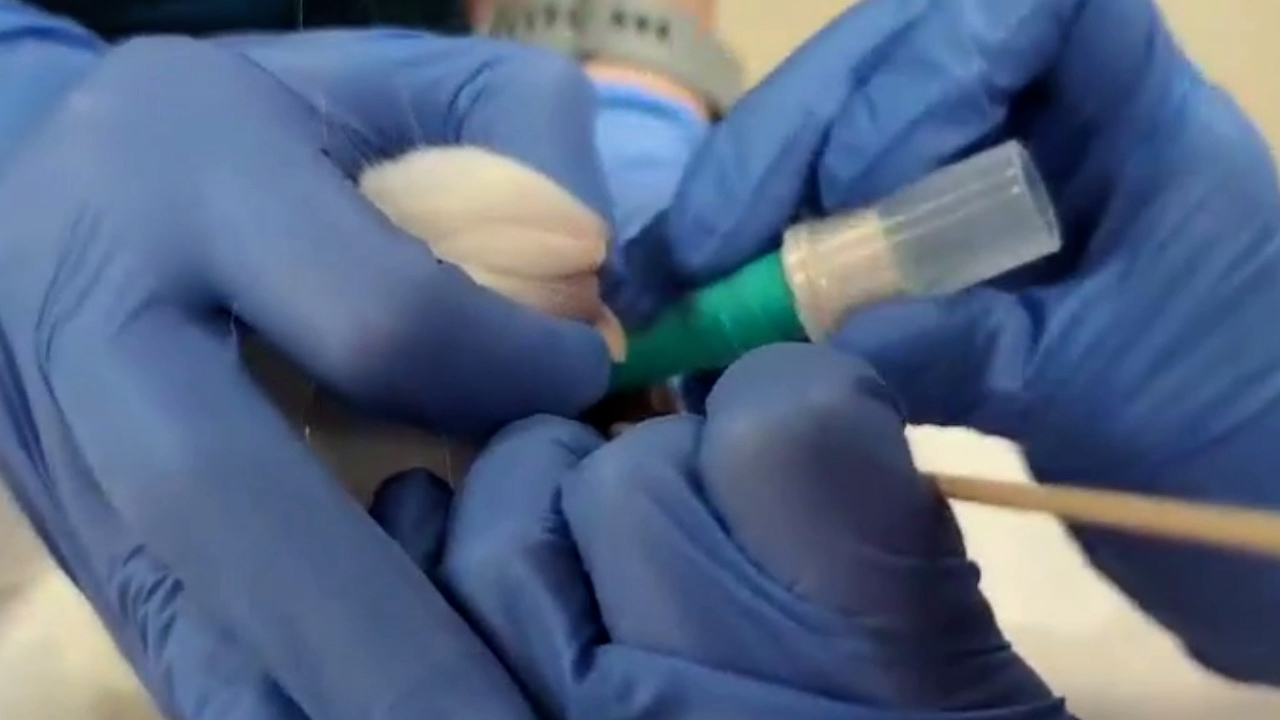 X-ray Visualization of Intraductal Ethanol-based Ablative Infusion for Prevention of Breast Cancer in Rabbit Models