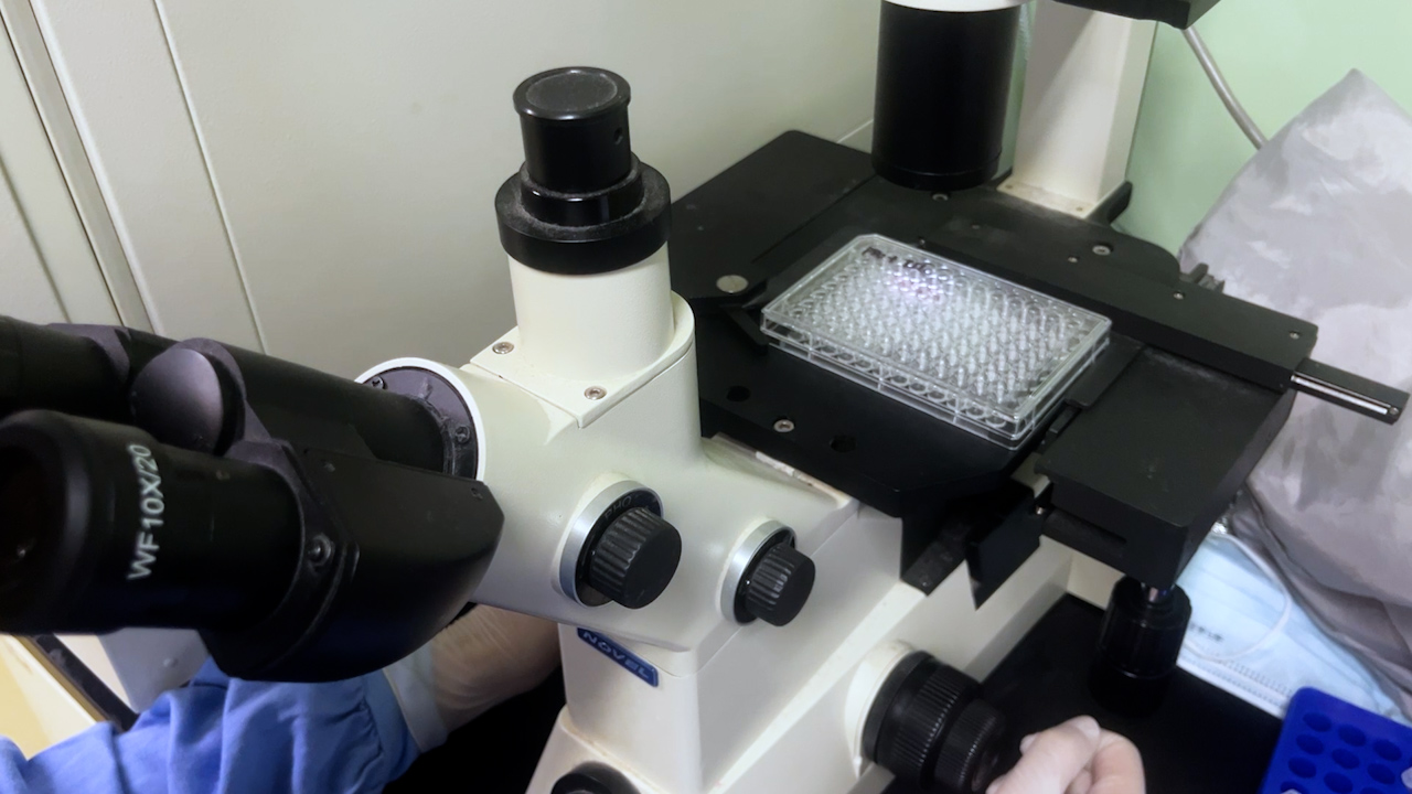Establishment of a Co-culture System of Patient-Derived Colorectal Tumor Organoids and Tumor-Infiltrating Lymphocytes (TILs)