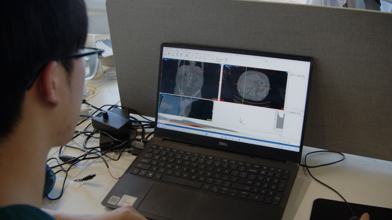 Utilizing a 3D Printed Laparoscopic Nissen Fundoplication Model to Shorten a Resident's Learning Curve