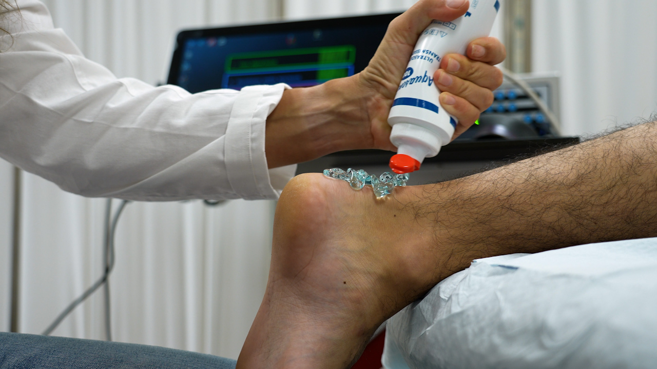 Ultrasound Tissue Characterization of Human Achilles Tendon by Stability Quantification of Echo Patterns