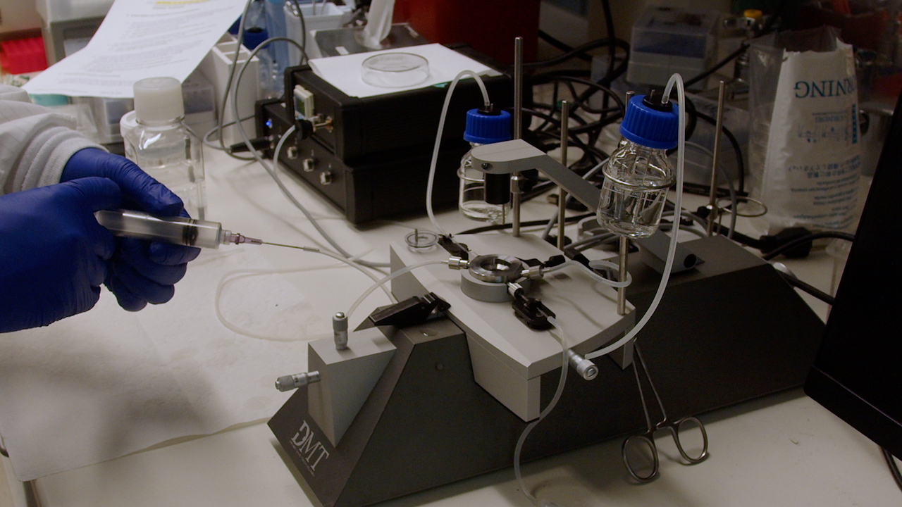 In Vitro Intraluminal Gel Infusion: An Advanced Approach for Microscopic Analysis of Human Resistance Arteries