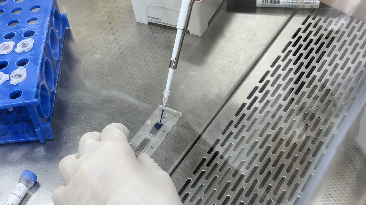 Detection of Aggregation-Prone Behavior in Mutant P53 V157F Breast Cancer Cells Using Multipoint Thioflavin T Fluorescence