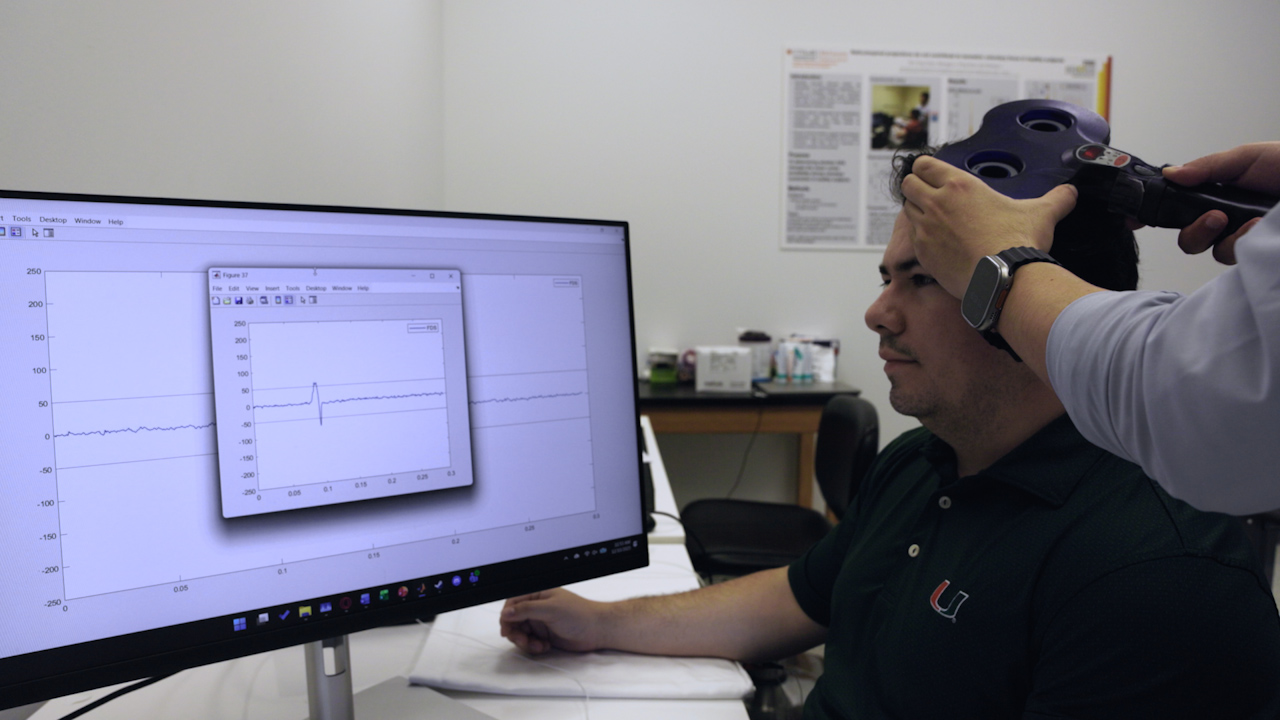 A Novel Scalp Acupuncture-based Method to Target the Hand Motor Hotspot for Non-invasive Brain Stimulation