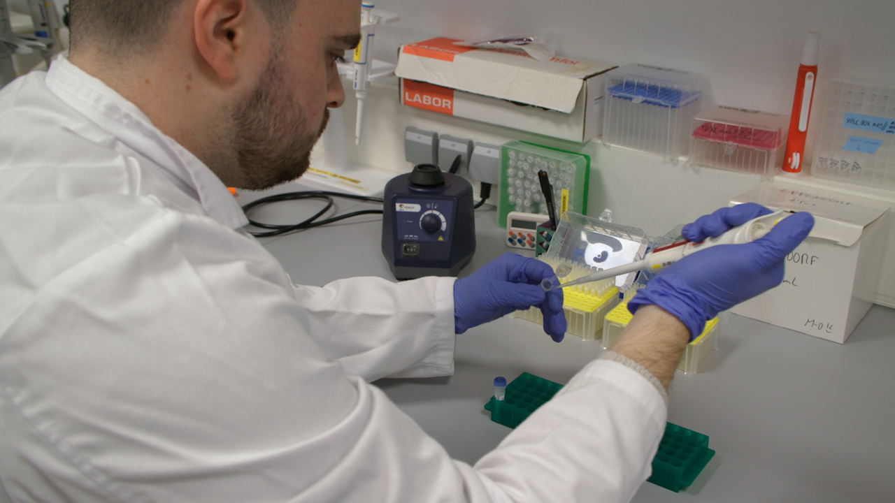 Proksimal tübüler epitel hücrelerinde hipoksi/reoksijenlenme yaralanmasının modellenmesi