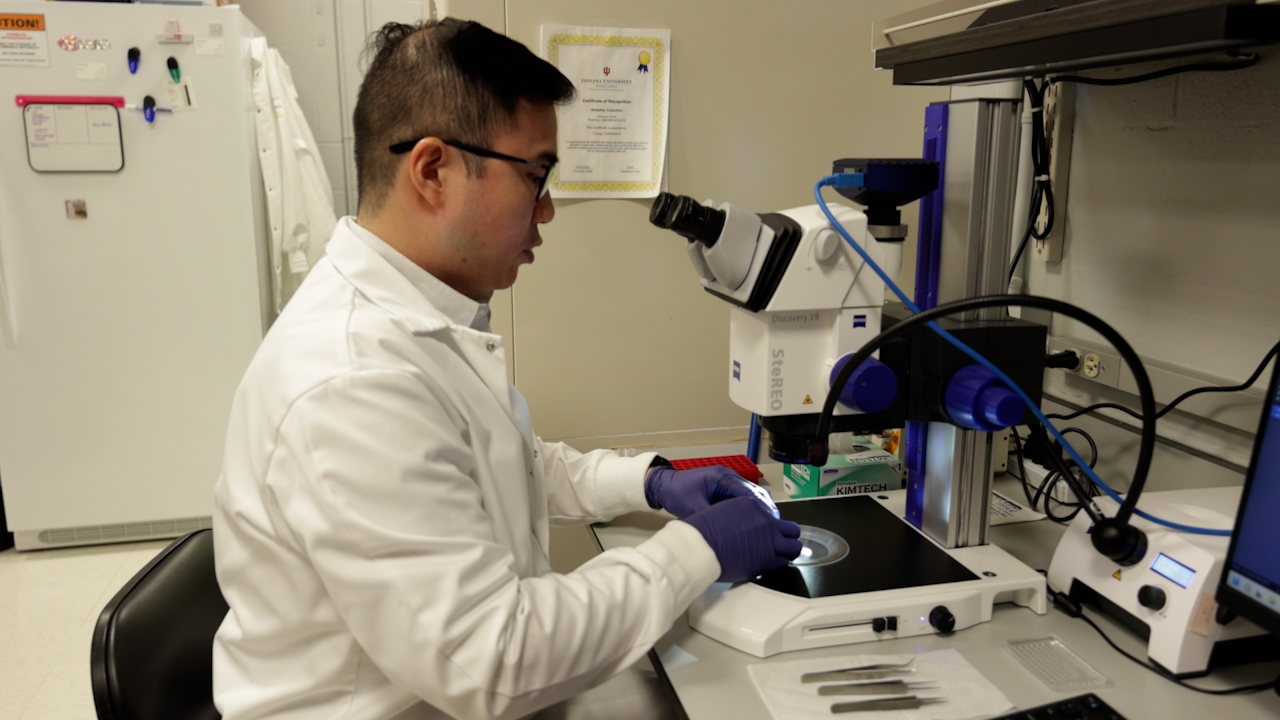 RNA Isolation from Mouse Ocular Lens Epithelium and Fiber Cell Bulk Masses
