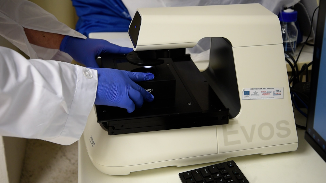 Automated Analysis of <em>C. elegans</em> Fluorescence Images using SegElegans