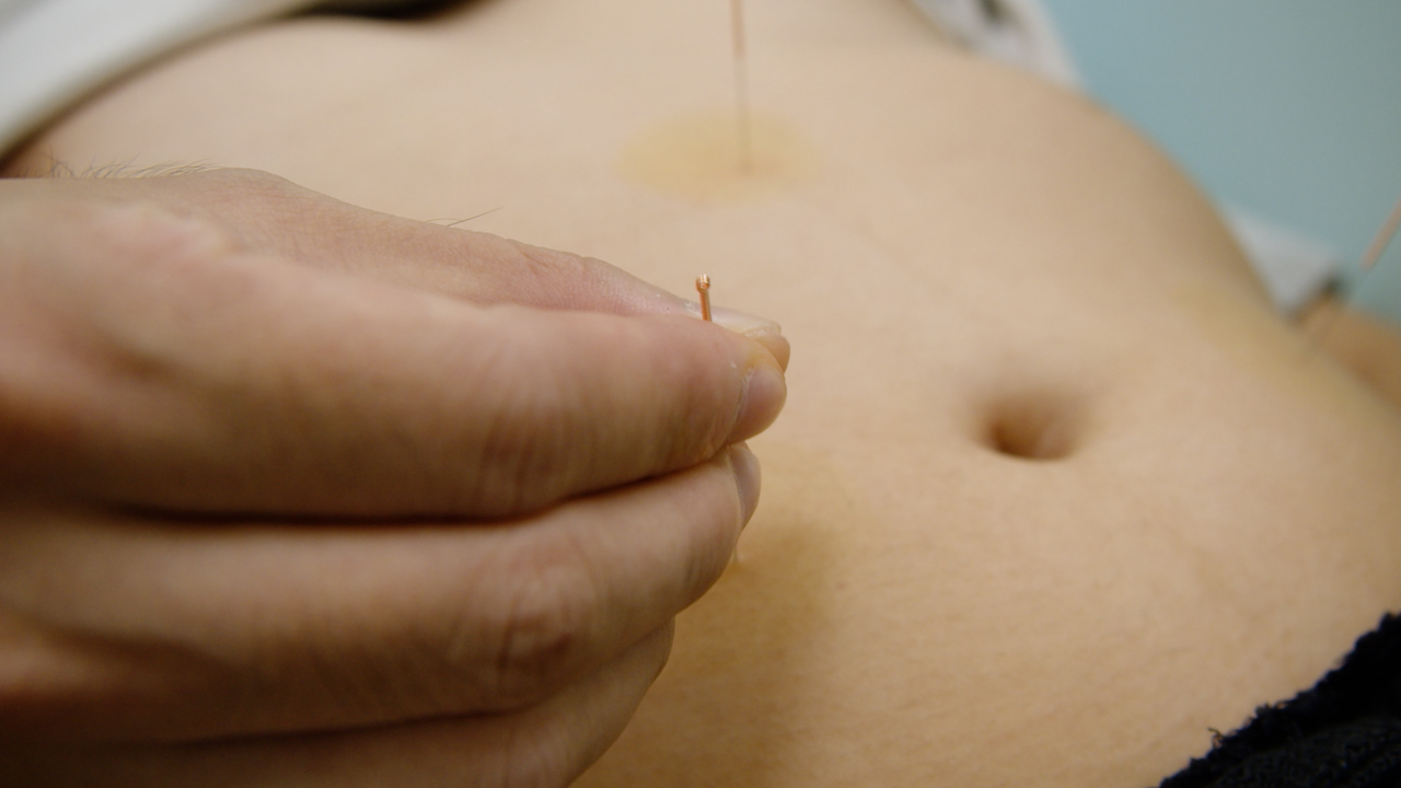 Influence of Emotional Factors on the Efficacy of Acupuncture Treatment for Overweight Complicated with Hyperlipidemia: A Retrospective Cohort Study