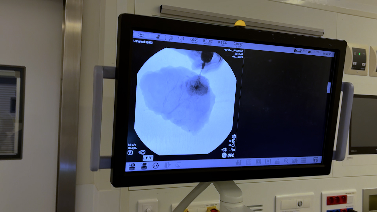 An Experimental Human DIEP Flap Model to Investigate Preservation Strategies for Vascularized Composite Allografts and Free Flaps