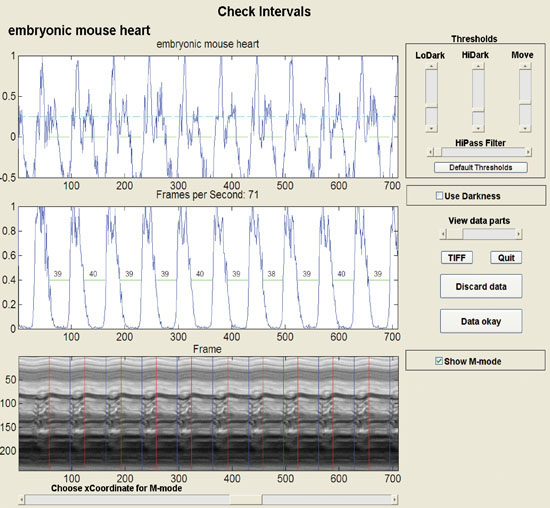 Check Mouse Heart Intervals