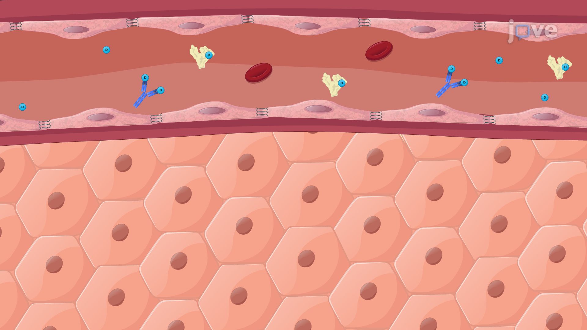 Effect of Hepatic Disease on Pharmacokinetics: Drug Dosing and Hepatic Blood Flow