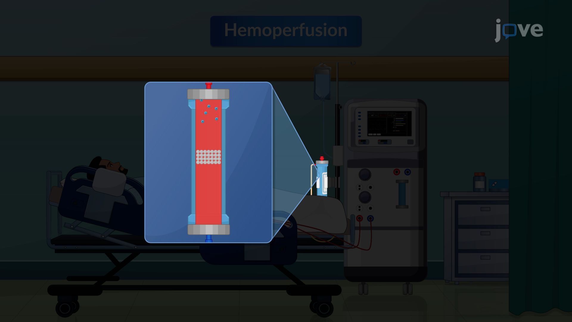 Extracorporeal Removal of Drugs: Hemoperfusion and Hemofiltration